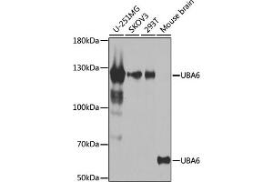 Western blot analysis of extracts of various cell lines, using UB antibody (ABIN6129502, ABIN6149769, ABIN6149771 and ABIN6223415) at 1:1000 dilution.