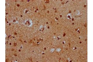 IHC image of ABIN7172561 diluted at 1:400 and staining in paraffin-embedded human brain tissue performed on a Leica BondTM system. (HES5 anticorps  (AA 1-166))
