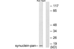 Western blot analysis of extracts from rat heart, using Synuclein-pan antibody (ABIN5976513).