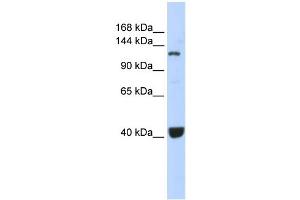 WB Suggested Anti-PIWIL1 Antibody Titration:  0. (PIWIL1 anticorps  (Middle Region))