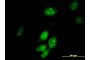 Immunofluorescence of purified MaxPab antibody to TRMT2A on HeLa cell. (TRMT2A anticorps  (AA 1-625))