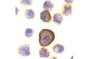 Immunohistochemistry (IHC) image for anti-TP53 Apoptosis Effector (PERP) (C-Term) antibody (ABIN1030575) (PERP anticorps  (C-Term))