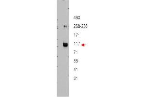Image no. 1 for anti-ATP-Binding Cassette, Sub-Family B (MDR/TAP), Member 5 (ABCB5) (Internal Region) antibody (ABIN401434) (ABCB5 anticorps  (Internal Region))