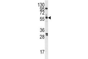 Western blot analysis of PLK antibody and A375 cell lysate.