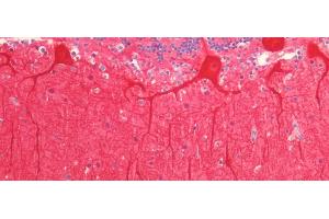 Detection of CALB in Human Cerebellum Tissue using Polyclonal Antibody to Calbindin (CALB)
