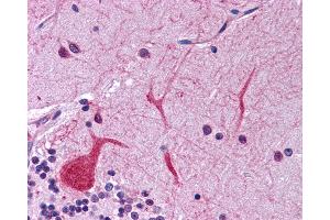 Immunohistochemistry (IHC) image for anti-Eukaryotic Translation Initiation Factor 2-alpha Kinase 1 (EIF2AK1) (N-Term) antibody (ABIN2775397) (EIF2AK1 anticorps  (N-Term))