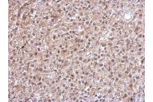 IHC-P Image Immunohistochemical analysis of paraffin-embedded HBL435 xenograft, using TrxR1, antibody at 1:500 dilution. (TXNRD1 anticorps)
