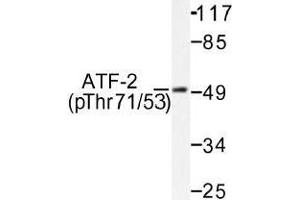 Image no. 1 for anti-Activating Transcription Factor 2 (ATF2) (pThr53), (pThr71) antibody (ABIN317966) (ATF2 anticorps  (pThr53, pThr71))