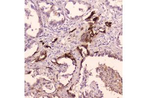IHC analysis of Cathepsin E using anti-Cathepsin E antibody (ABIN5692831). (Cathepsin E anticorps  (AA 150-393))