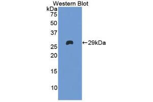 Western blot analysis of the recombinant protein. (Factor XI anticorps  (AA 170-398))
