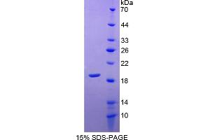Image no. 1 for Superoxide Dismutase 1, Soluble (SOD1) (AA 2-153) protein (His tag) (ABIN6238035) (SOD1 Protein (AA 2-153) (His tag))