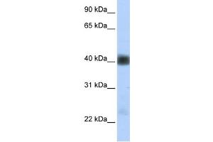 WB Suggested Anti-SGCB Antibody Titration:  0. (SGCB anticorps  (Middle Region))
