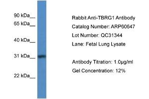 WB Suggested Anti-TBRG1  Antibody Titration: 0.