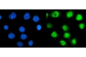 IF analysis of TBP-1/PSMC3 using anti-TBP-1/PSMC3 antibody (ABIN7599392).
