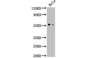 Western Blot Positive WB detected in: Hela whole cell lysate All lanes: NR0B1 antibody at 2. (PPP1R9A anticorps  (AA 1-243))