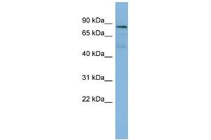 WB Suggested Anti-PTPN12 Antibody Titration: 0. (PTPN12 anticorps  (Middle Region))