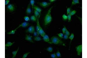 Immunofluorescence staining of U251 cells with ABIN7146257 at 1:200, counter-stained with DAPI.