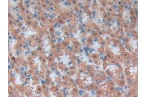 Detection of LOX1 in Rat Stomach Tissue using Polyclonal Antibody to Lectin Like Oxidized Low Density Lipoprotein Receptor 1 (LOX1) (OLR1 anticorps  (AA 51-314))