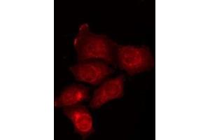 ABIN6275881 staining HepG2 by IF/ICC. (ATG16L2 anticorps  (Internal Region))