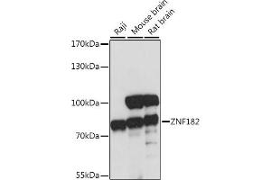 Western blot analysis of extracts of various cell lines, using ZNF182 antibody (ABIN7271462) at 1:1000 dilution.