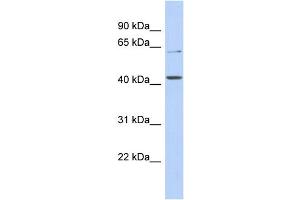 WB Suggested Anti-SLC22A12 Antibody Titration:  0. (SLC22A12 anticorps  (N-Term))
