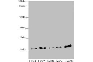 Western blot All lanes: COMMD1 antibody at 5. (COMMD1 anticorps  (AA 1-190))