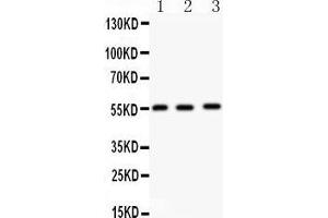 Anti- MMP14 Picoband antibody, Western blotting All lanes: Anti MMP14  at 0. (MMP14 anticorps  (C-Term))