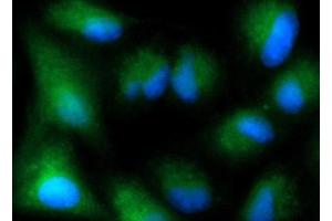 Immunofluorescence (IF) image for anti-Proteasome (Prosome, Macropain) 26S Subunit, Non-ATPase, 5 (PSMD5) (AA 1-504) antibody (FITC) (ABIN5567669)