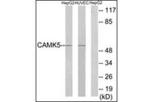 Western blot analysis of extracts from HepG2/HuvEc cells, using CAMK5 Antibody. (CAMKV anticorps)