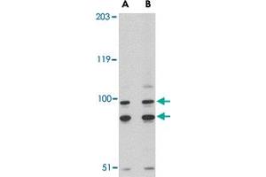Western blot analysis of SATB1 in A-20 cell lysate with SATB1 polyclonal antibody  at (A) 2 and (B) 4 ug/mL . (SATB1 anticorps  (C-Term))
