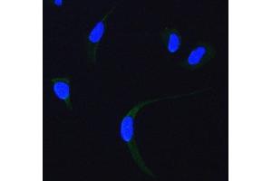 IF analysis of SDHA using anti-SDHA antibody (ABIN7602753).