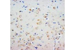 Immunohistochemical analysis of paraffin embedded rat tissue sections (brain), staining SHH in cytoplasm, DAB chromogenic reaction (Sonic Hedgehog anticorps  (N-Term))