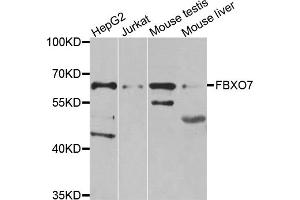 Western blot analysis of extracts of various cell lines, using FBXO7 antibody (ABIN5975552) at 1/1000 dilution.