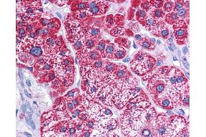 HADHB antibody was used for immunohistochemistry at a concentration of 4-8 ug/ml. (HADHB anticorps)