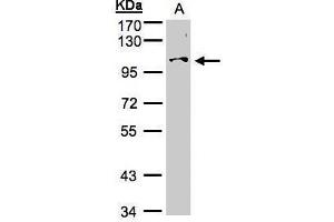 WB Image Sample (30μg whole cell lysate) A:Hep G2 , 7. (NCKAP1 anticorps)