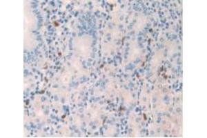 IHC-P analysis of Human Stomach Tissue, with DAB staining. (Amylin/DAP anticorps)