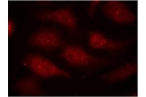 Image no. 1 for anti-Cyclin-Dependent Kinase 6 (CDK6) (pTyr24) antibody (ABIN319290) (CDK6 anticorps  (pTyr24))