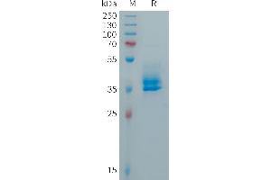 Human CALCA(85-141) Protein, hFc Tag on SDS-PAGE under reducing condition.