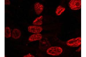 Immunofluorescence staining of methanol-fixed Hela cells using p53(Phospho-Ser15) Antibody.