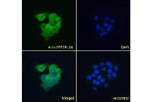 ABIN6391349 Immunofluorescence analysis of paraformaldehyde fixed A431 cells, permeabilized with 0. (PPP1R12A anticorps  (C-Term))