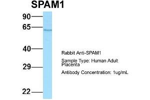 Host: Rabbit Target Name: SPAM1 Sample Type: Human Adult Placenta Antibody Dilution: 1. (SPAM1 anticorps  (C-Term))