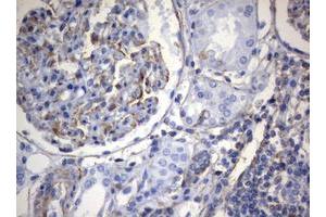 Image no. 7 for anti-Vimentin (VIM) (AA 210-466) antibody (ABIN1491200)