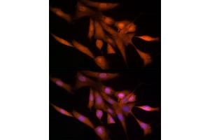 Immunofluorescence analysis of NIH/3T3 cells using Ube2L3 / UBCH7 Rabbit mAb (ABIN7271178) at dilution of 1:25 (40x lens). (UBE2L3 anticorps)