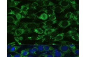 Immunofluorescence analysis of NIH-3T3 cells using GLUD1 Polyclonal Antibody at dilution of 1:100.