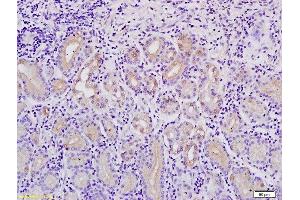 Formalin-fixed and paraffin embedded human stomach tissue labeled with Anti-MACC1Polyclonal Antibody, Unconjugated  followed by conjugation to the secondary antibody and DAB staining (MACC1 anticorps  (AA 761-852))