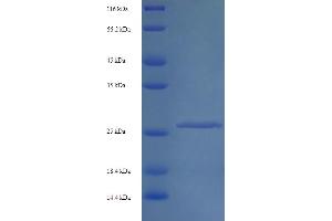 SDS-PAGE (SDS) image for Interferon alpha/beta Receptor 2 (IFNAR2) (AA 22-242) protein (His tag) (ABIN5713534)