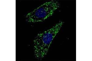 Fluorescent image of U251 cells stained with LAMP1 antibody at 1:200.