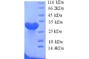SDS-PAGE (SDS) image for Potassium Inwardly-Rectifying Channel, Subfamily J, Member 1 (KCNJ1) (AA 178-391), (Cytoplasmic Domain), (Cytosolic) protein (His tag) (ABIN5713578)