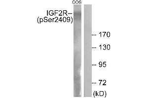 Immunohistochemistry analysis of paraffin-embedded human brain tissue using IGF2R (Phospho-Ser2409) antibody. (IGF2R anticorps  (pSer2409))