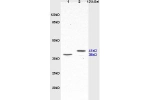 L1 rat lung lysates L2 human lung carcinoma lysates probed with Anti SP-D/PSPD Polyclonal Antibody, Unconjugated (ABIN731678) at 1:200 in 4 °C.